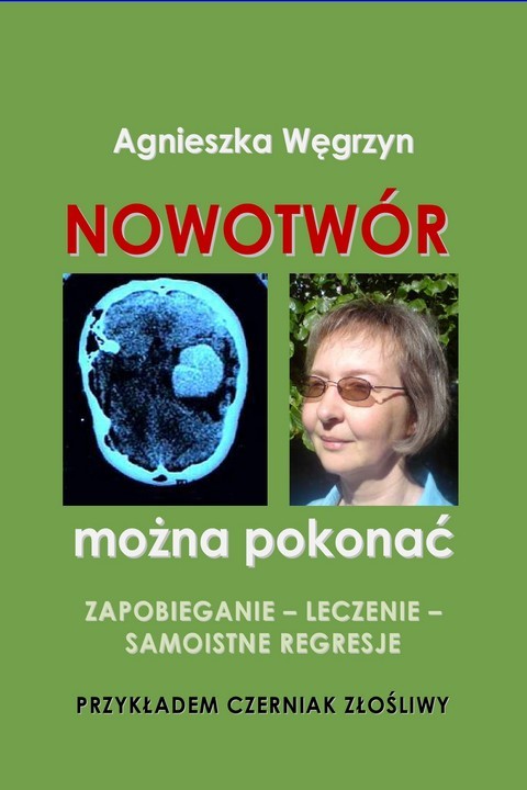okładka Nowotwór można pokonać ebook | pdf | Agnieszka Węgrzyn
