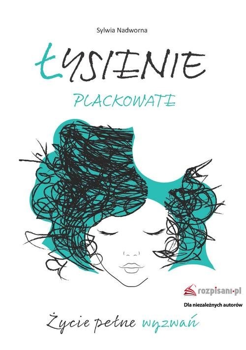 okładka Łysienie plackowate Życie pełne wyzwań książka | Nadworna Sylwia