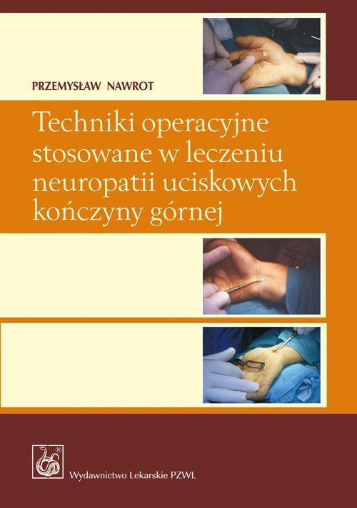 okładka Techniki operacyjne stosowane w leczeniu neuropatii uciskowych kończyny górnej. ebook | epub, mobi | Przemysław Nawrot