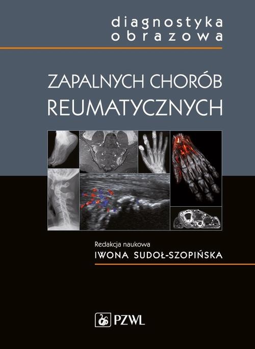 okładka Diagnostyka obrazowa zapalnych chorób reumatycznych ebook | epub, mobi