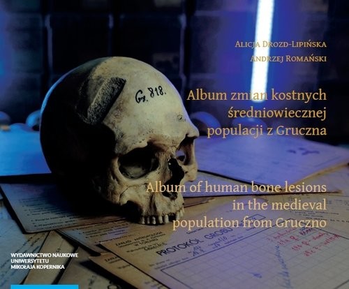 okładka Album zmian kostnych średniowiecznej populacji z Gruczna Album of human bone lesions in the medieva książka