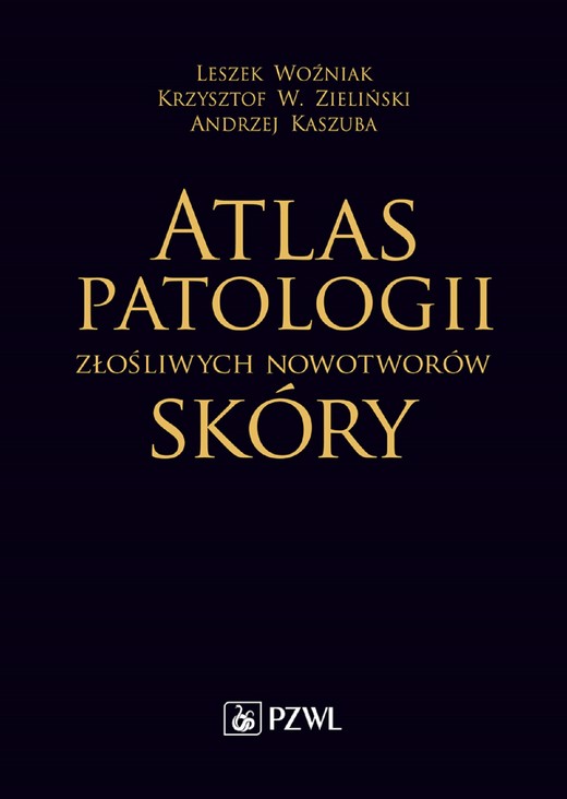 okładka Atlas patologii złośliwych nowotworów skóry ebook | epub, mobi | Krzysztof W. Zieliński, Leszek Woźniak, Andrzej Kaszuba