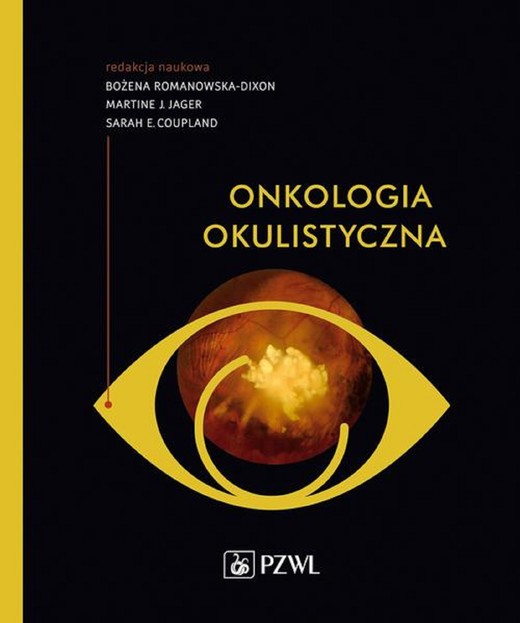 okładka Onkologia okulistyczna ebook | epub, mobi | Bożena Romanowska-Dixon, Martine Jager, Sarah Coupland