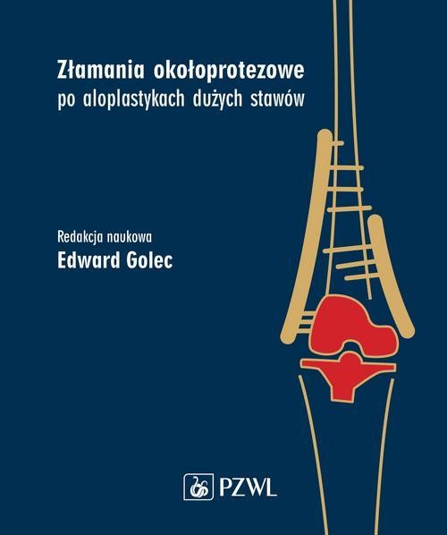 okładka Złamania okołoprotezowe po aloplastykach dużych stawów ebook | epub, mobi