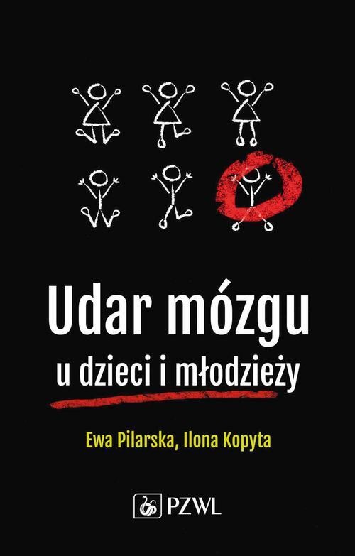 okładka Udar mózgu u dzieci i młodzieży ebook | epub, mobi | Ewa Pilarska, Ilona Kopyta, Robert Sabiniewicz