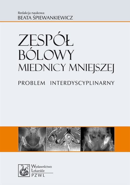 okładka Zespół bólowy miednicy mniejszej. Problem interdyscyplinarny ebook | epub, mobi | Opracowania Zbiorowe
