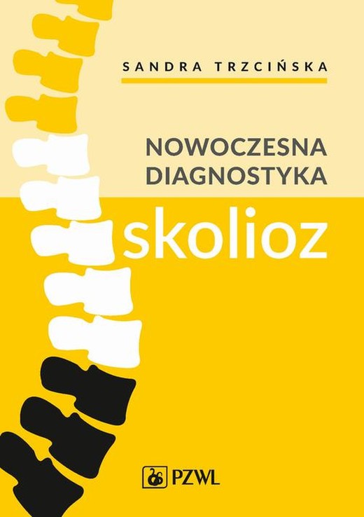 okładka Nowoczesna diagnostyka skolioz ebook | epub, mobi | Sandra Trzcińska, Kamil Koszela, Andrzej Myśliwiec, Arkadiusz Żurawski