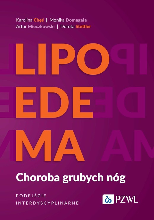 okładka Lipoedema ebook | epub, mobi | Karolina Chęś, Monika Domagała, Artur Mieczkowski, Dorota Stettler