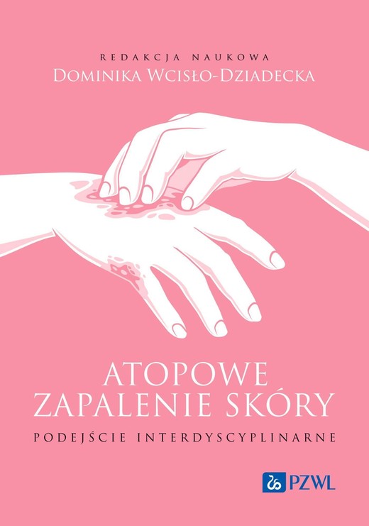 okładka Atopowe zapalenie skóry Podejście interdyscyplinarne ebook | epub, mobi | Dominika Wcisło-Dziadecka