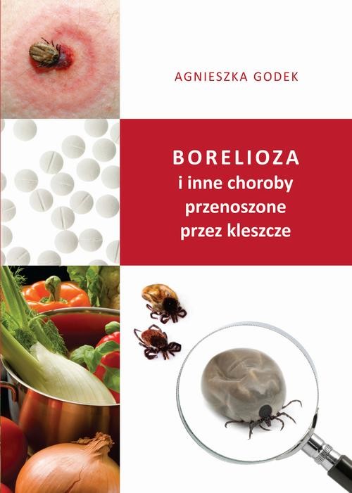 okładka Borelioza i inne choroby przenoszone przez kleszcze ebook | epub, mobi | Agnieszka Godek