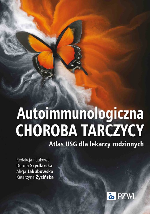 okładka Autoimmunologiczna choroba tarczycy ebook | epub, mobi | Katarzyna Życińska, Alicja Jakubowska, Dorota Szydlarska