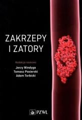 okładka Zakrzepy i zatory książka | Praca Zbiorowa