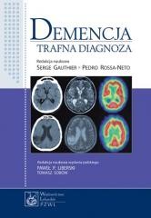 okładka Demencja książka | Pedro Rosa-Neto, Serge Gauthier