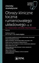 okładka Obrazy kliniczne tocznia rumieniowatego układ cz.2 książka | Majdan Maria