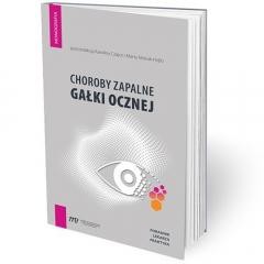 okładka Choroby zapalne gałki ocznej - poradnik lekarza pr książka | Praca Zbiorowa