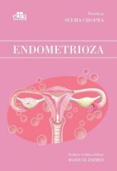 okładka Endometrioza książka | S Chopra