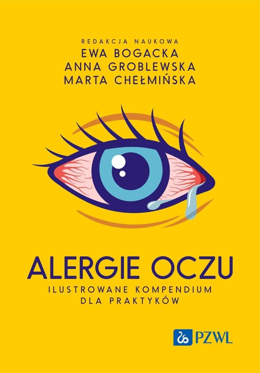 okładka Alergie oczu. Ilustrowane kompendium dla praktyków ebook | epub, mobi | Ewa Bogacka, Anna Groblewska