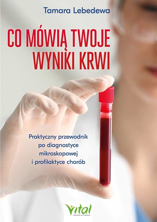 okładka Co mówią twoje wyniki krwi. Praktyczny przewodnik po diagnostyce mikroskopowej i profilaktyce chorób książka | Lebedewa Tamara