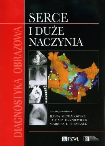 okładka Diagnostyka obrazowa Serce i duże naczynia książka | Michałowska Ilona, Tomasz Hryniewiecki