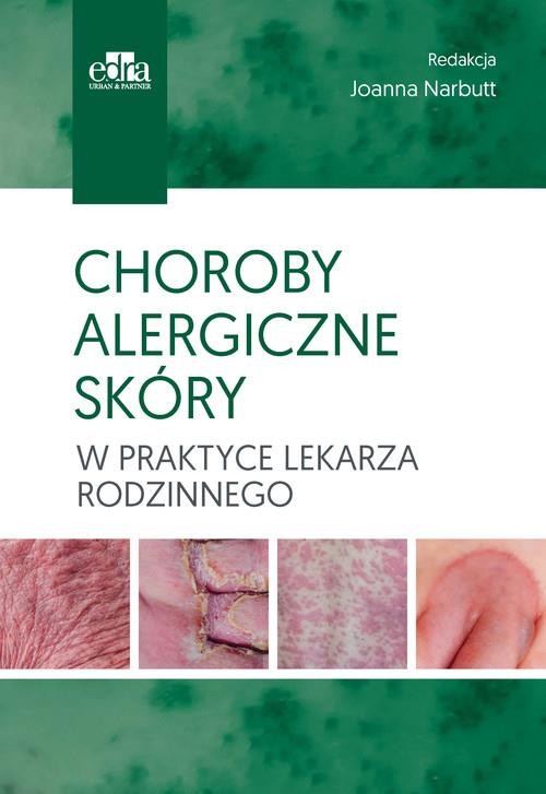 okładka Choroby alergiczne skóry w praktyce lekarza rodzinnego książka | Joanna Narbutt