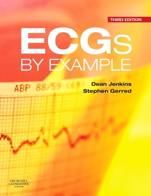 okładka Ecgs By Example książka | Dean Jenkins, Stephen JohnGerred