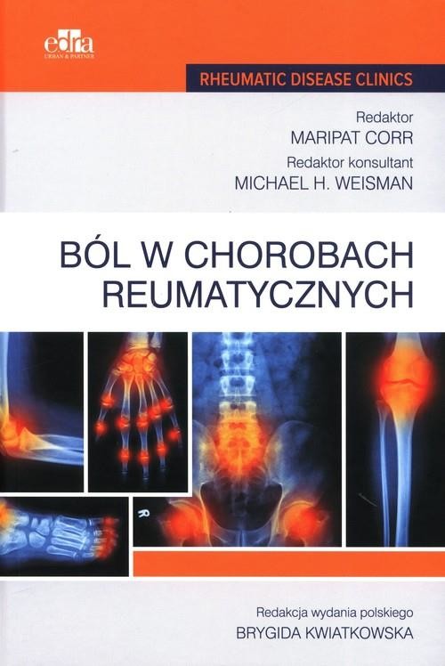 okładka Ból w chorobach reumatycznych książka | Corr M.