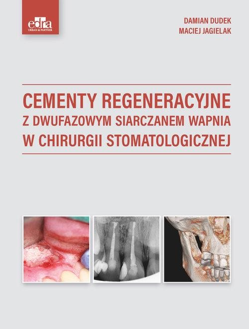okładka Cementy regeneracyjne z dwufazowym siarczanem wapnia w chirurgii stomatologicznej książka | Jagielak M., Dudek D.