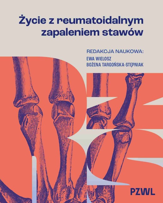 okładka Życie z reumatoidalnym zapaleniem stawów książka | Bożena Targońska-Stępniak, Wielosz Ewa