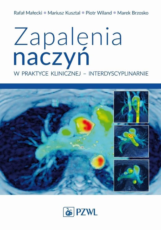 okładka Zapalenia naczyń w praktyce klinicznej... książka | Praca Zbiorowa