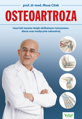 Okładka:Osteoartroza. Usuń ból stawów dzięki delikatnym ćwiczeniom, diecie oraz medycynie naturalnej - PDF 