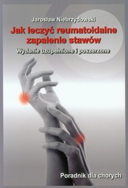 Jak leczyć reumatoidalne zapalenie stawów Poradnik dla chorych