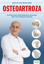 Osteoartroza. Usuń ból stawów dzięki delikatnym ćwiczeniom, diecie oraz medycynie naturalnej - PDF
