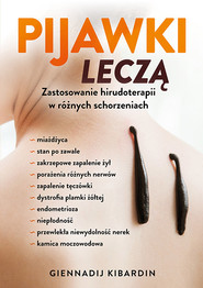 Pijawki leczą Zastosowanie hirudoterapii w różnych schorzeniach