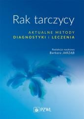 Rak tarczycy. Aktualne metody diagnostyki i leczen