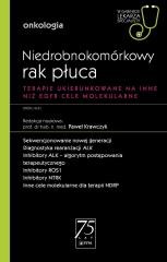 Niedrobnokomórkowy rak płuca. W gabinecie lekarza