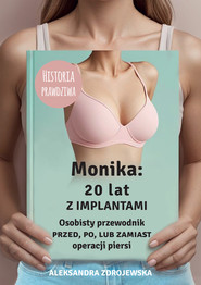 Monika: 20 lat z implantami