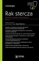Rak stercza. Współczesne spojrzenie