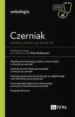 Czerniak. Współczesne leczenie (5)