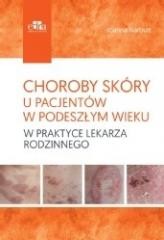 Choroby skóry u pacjentów w podeszłym wieku