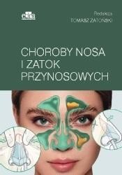 Oct i octa w chorobach siatkówki