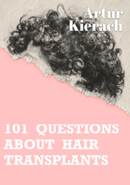 101 questions about hair transplants