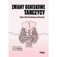 Zmiany ogniskowe tarczycy