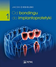 Od bondingu do implantoprotetyki cz. I