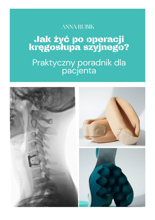 okładka Jak żyć po operacji kręgosłupa szyjnego? ebook | epub, mobi | Anna Rubik