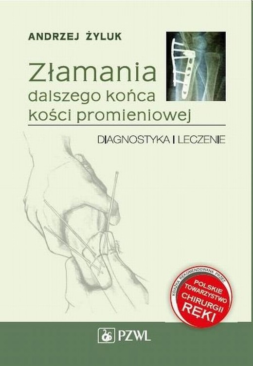 okładka Złamania dalszego końca kości promieniowej ebook | epub, mobi | Andrzej Żyluk