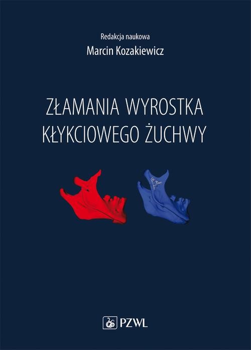 okładka Złamania wyrostka kłykciowego żuchwy ebook | epub, mobi | Marcin Kozakiewicz