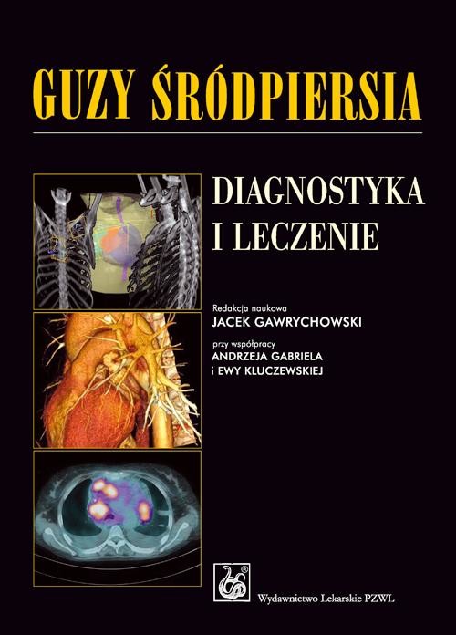 okładka Guzy śródpiersia. Diagnostyka i leczenie ebook | epub, mobi