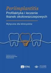 okładka Periimplantitis. Profilaktyka i leczenie tkanek... książka | Elżbieta Dembowska