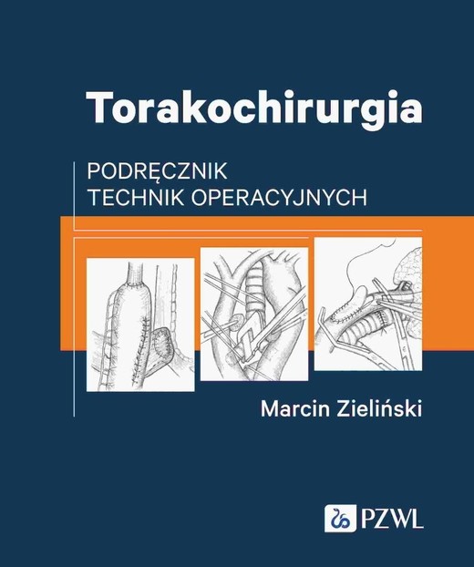 okładka Torakochirurgia. Podręcznik technik operacyjnych książka | Marcin Zieliński