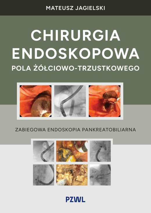 okładka Chirurgia endoskopowa pola żółciowo-trzustkowego. Zabiegowa endoskopia pankreatobiliarna książka | Mateusz Jagielski
